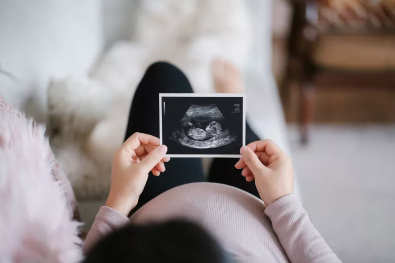 Pregnant lady looking at her sonogram. 